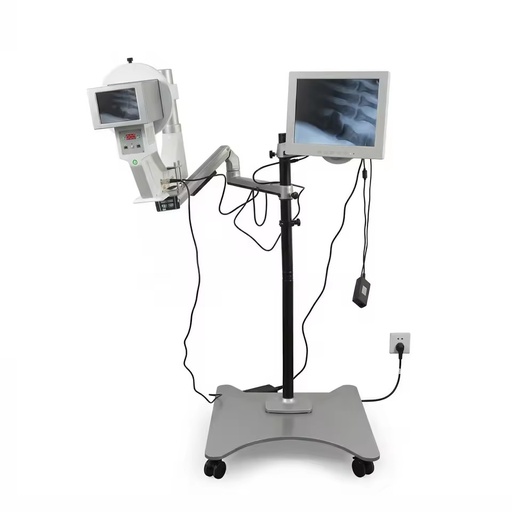 High Frequency Mini X Ray Machine Handheld Portable Fluoroscopic X-ray Machine for Podiatry Use